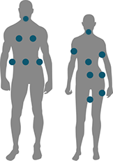 cryolipolyse paris 