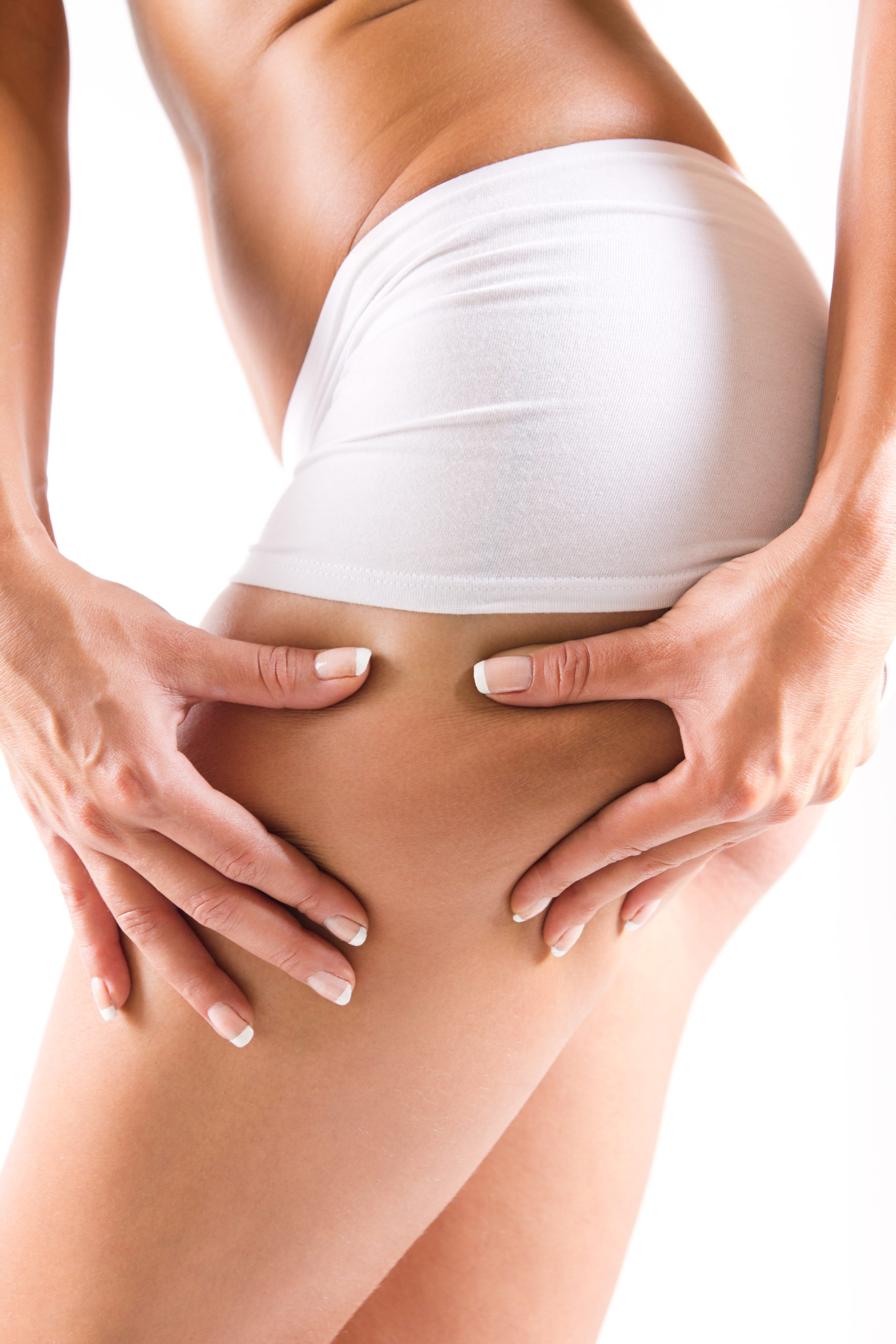 cellulite solution cryolipolyse traitement