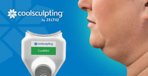 cryolipolyse paris coolsculpting